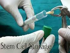 dental stem cell ahmedabad